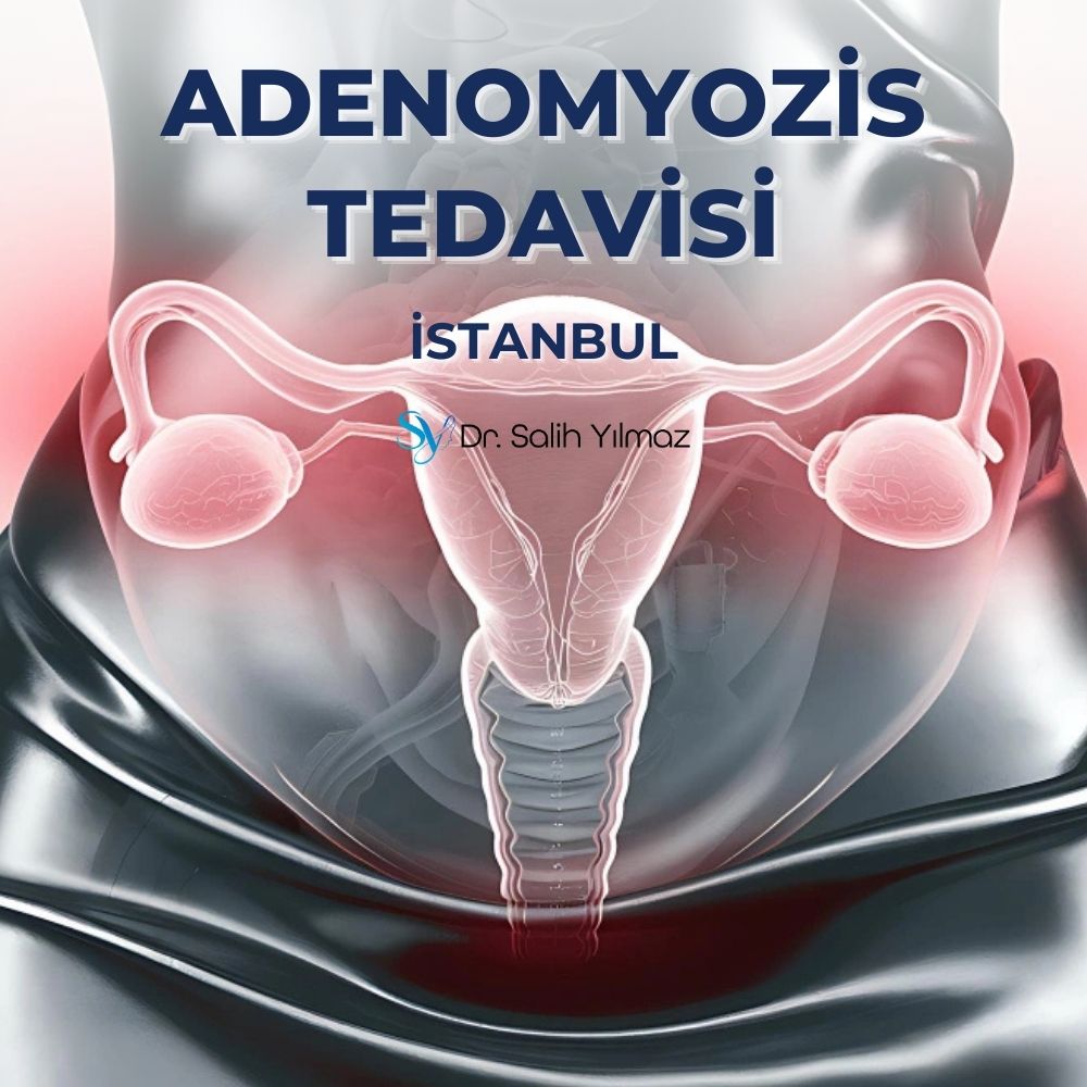 Adenomyozis tedavisi istanbul