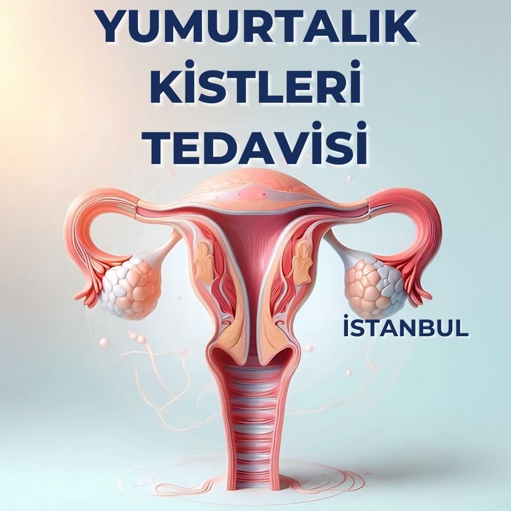 Yumurtalık Kistleri Ameliyati İstanbul